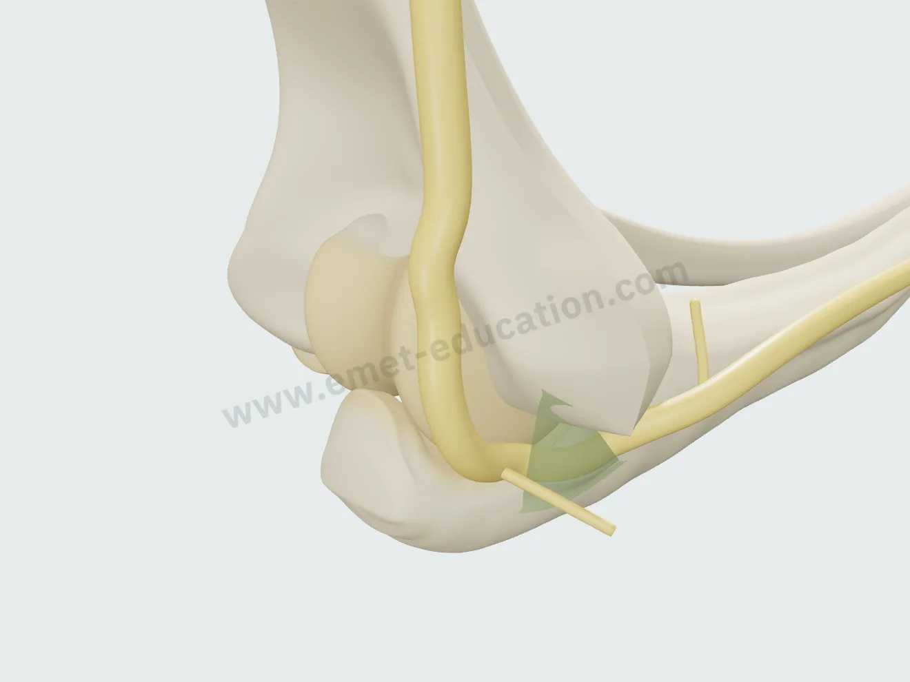 Elbow flexed to 100°, nerve stable at the floor of its groove.