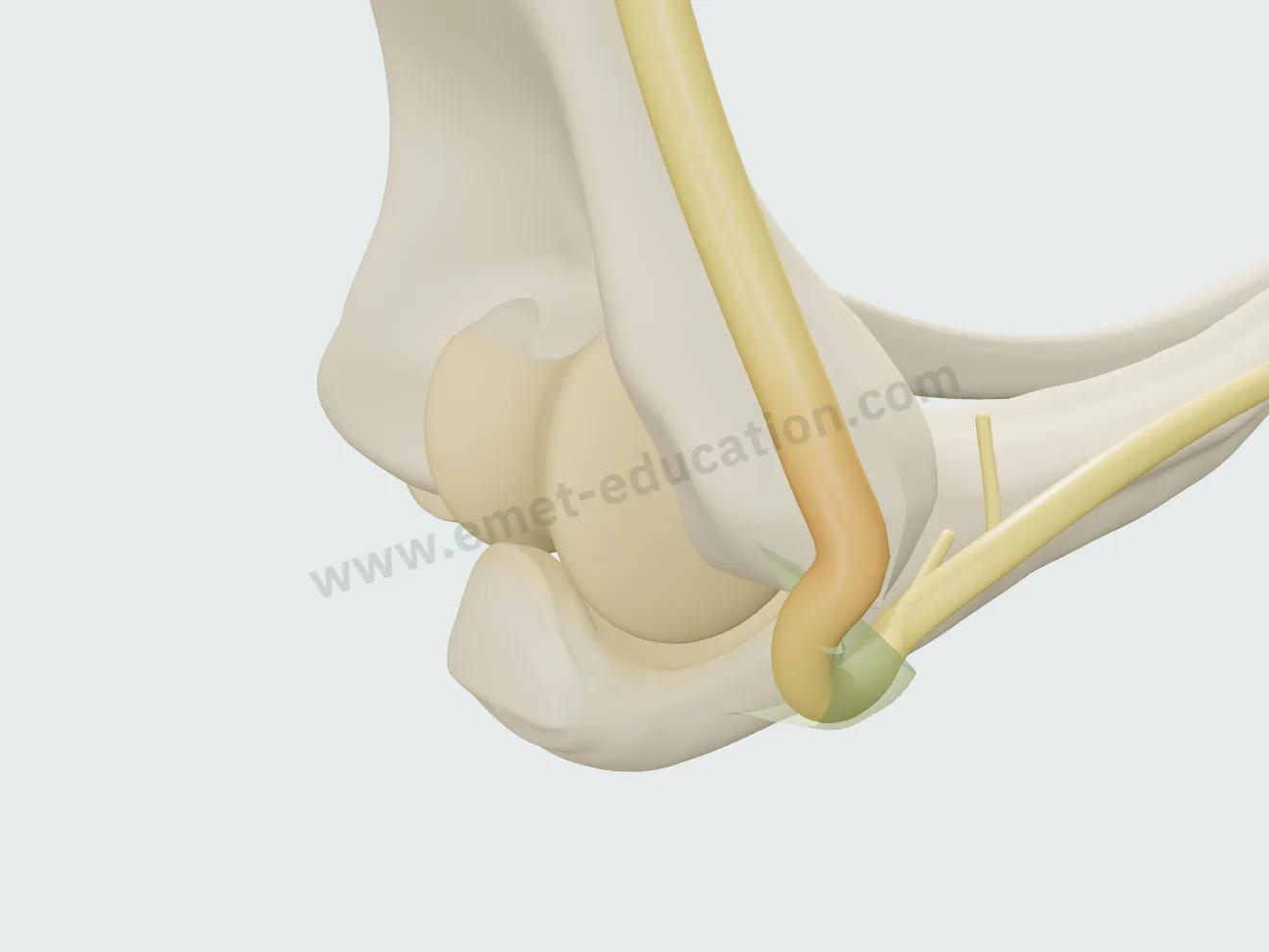 Subluxation: elbow flexed, the nerve perched on the tip of the medial epicondyle.