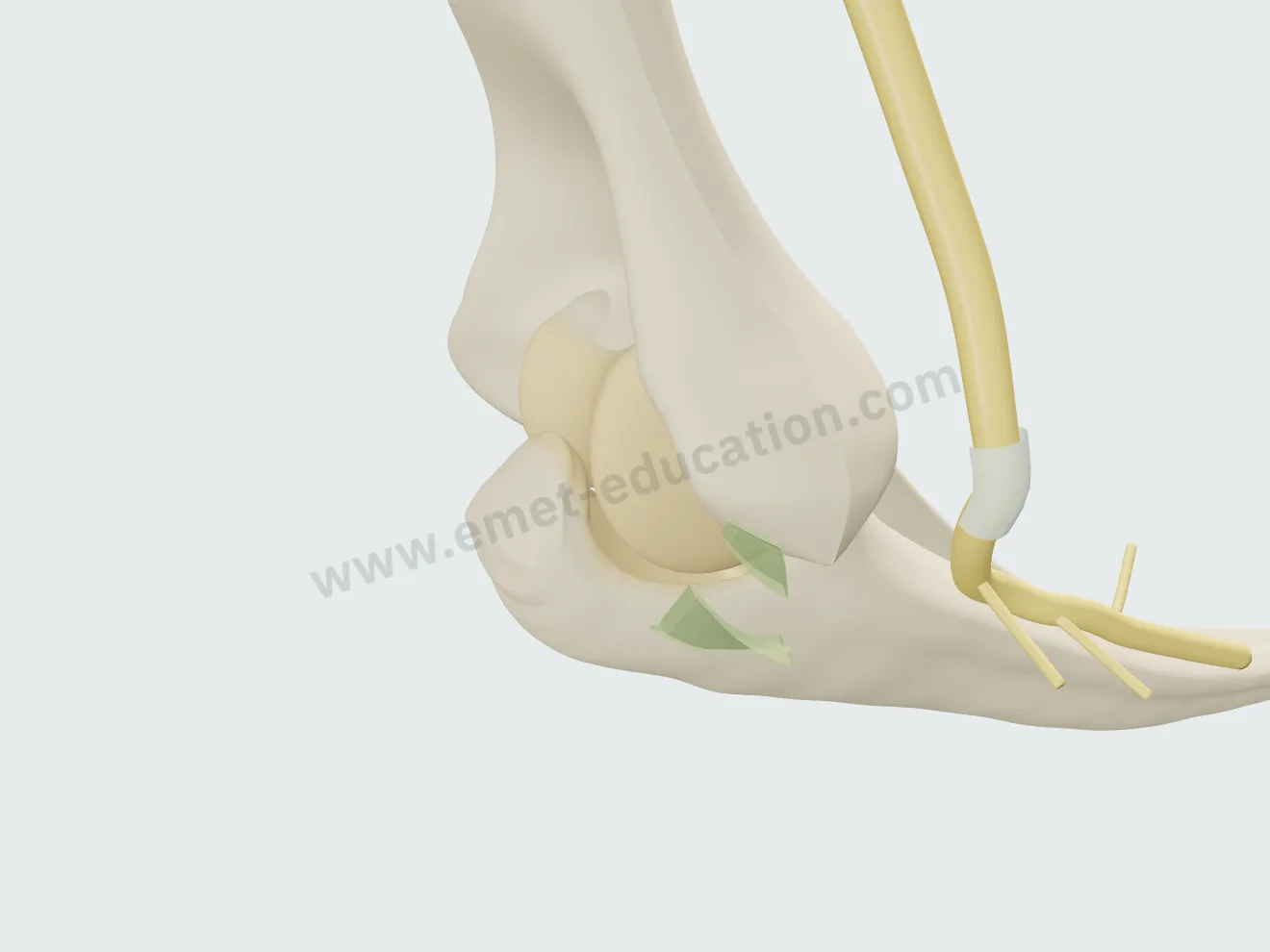 Transposition, step 3: a fascial sling passed over the transposed nerve.