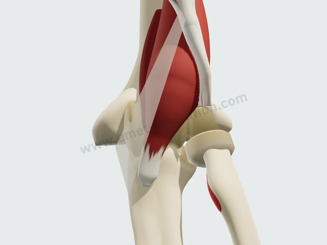 Nonoperative treatment, step 2: the tendon end scars onto the anterior brachialis.