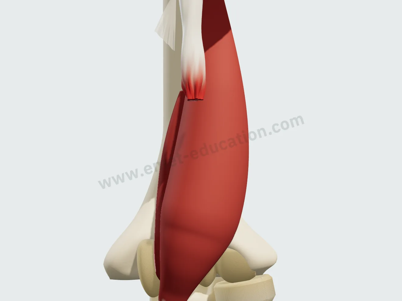 Lacertus torn: the tendon end retracted 80 mm up the arm.