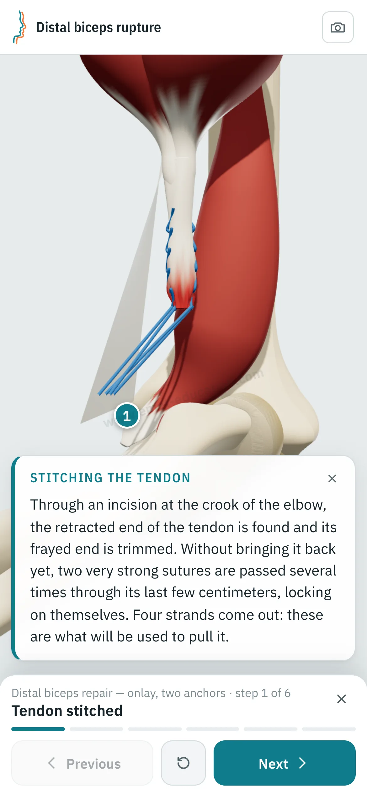 Patient view on a phone: the repair replayed step by step.