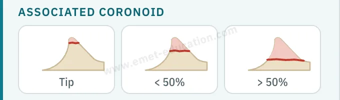 Model panel: associated coronoid fracture, tip, less than 50%, more than 50%.