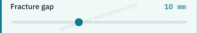 Model slider: fracture gap, from 4 to 20 mm.