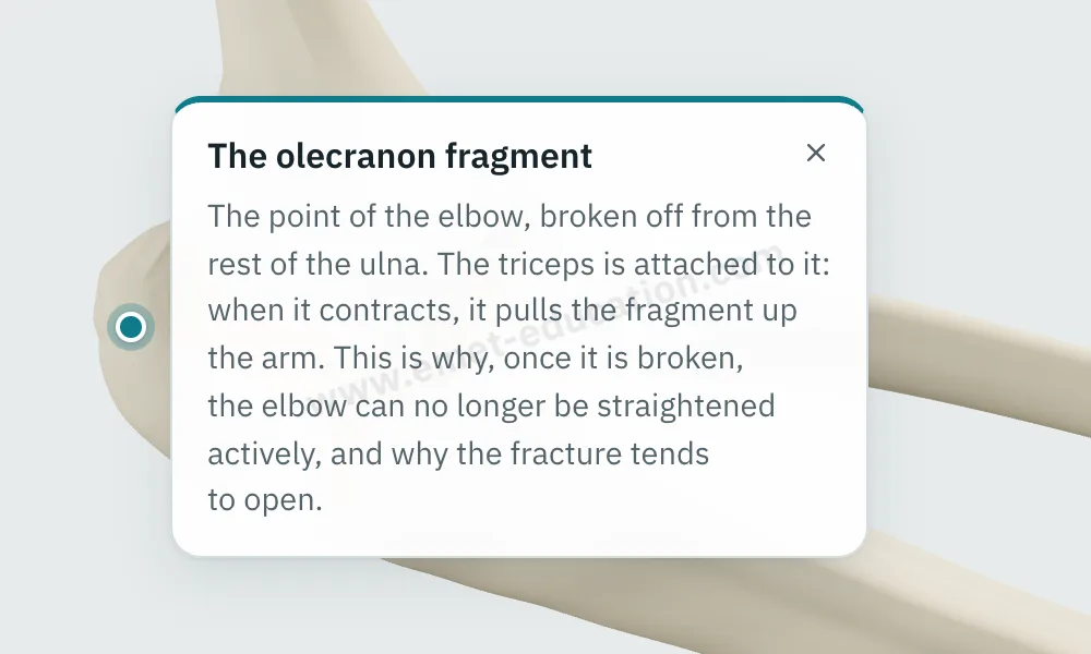 Explanation bubble “The olecranon fragment” shown after tapping the bone.