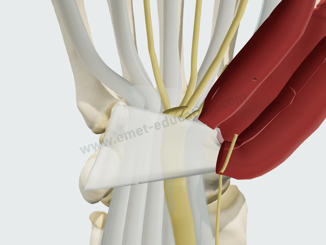 Extraligamentous thenar branch (Lanz I), the most frequent course.