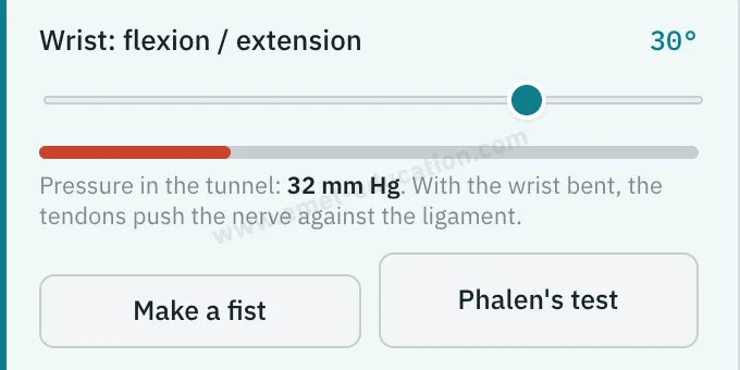Model panel: wrist flexion, tunnel pressure gauge, “Make a fist” and “Phalen's test” buttons.