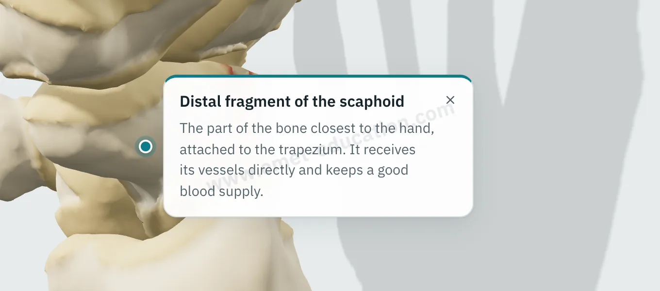 Explanation bubble “Distal fragment of the scaphoid” shown after tapping the fragment.