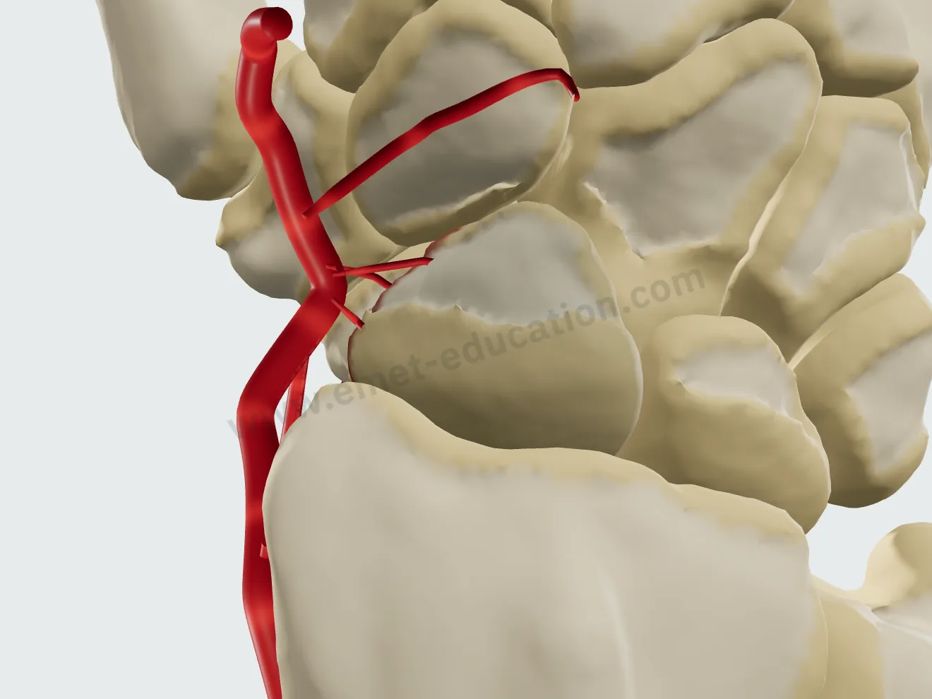 Waist fracture, dorsal view: part of the proximal pole vessels is interrupted.