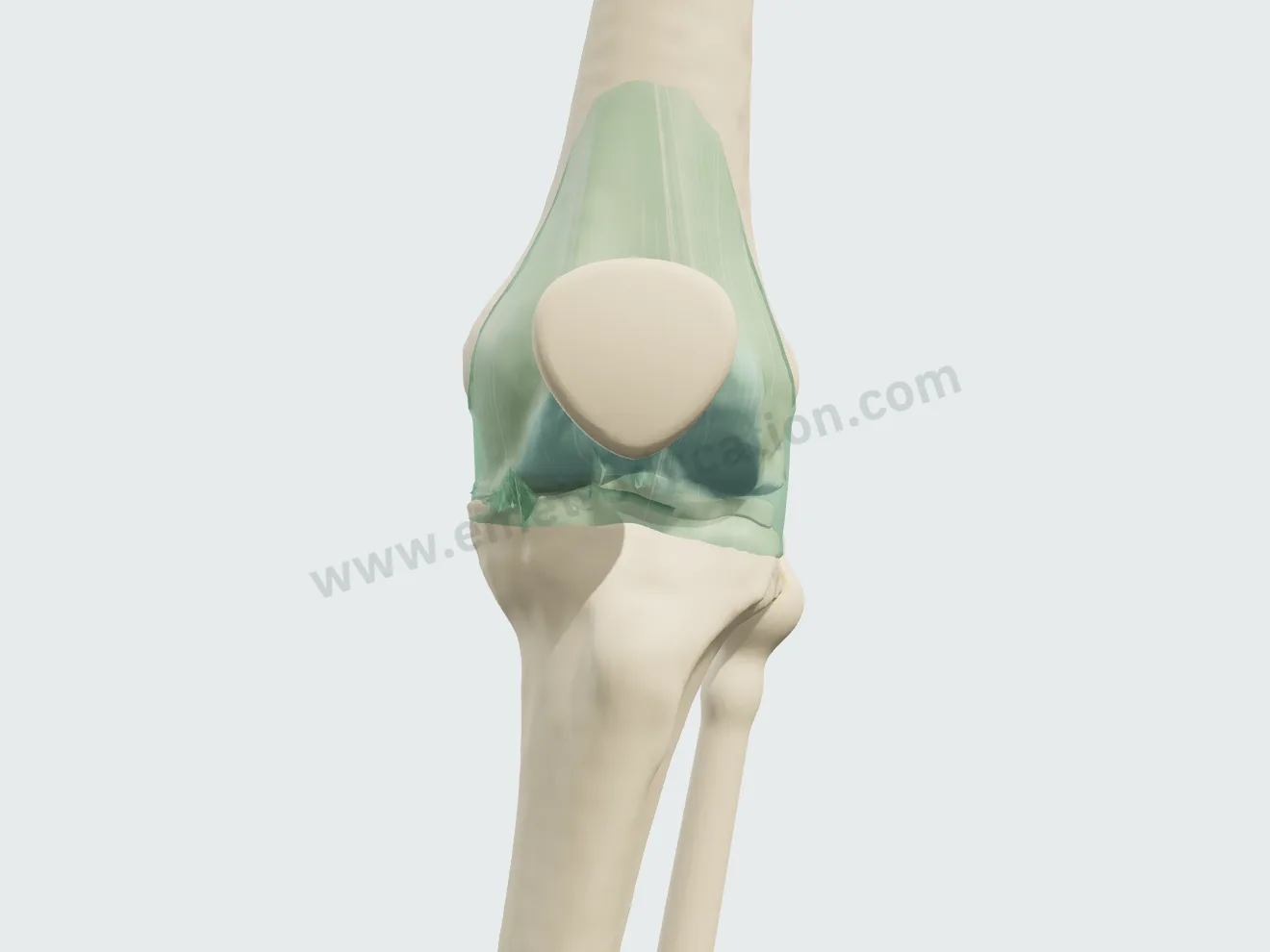 Injection, step 4: synovitis settled, effusion gone, osteoarthritis unchanged.