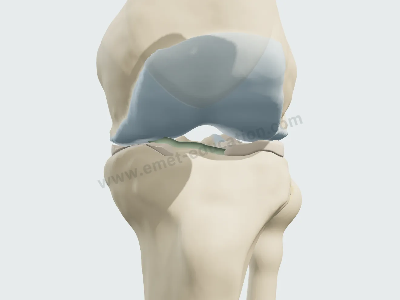 Knee from the front, grade I: thinned, dull cartilage, small marginal osteophyte, normal joint space.