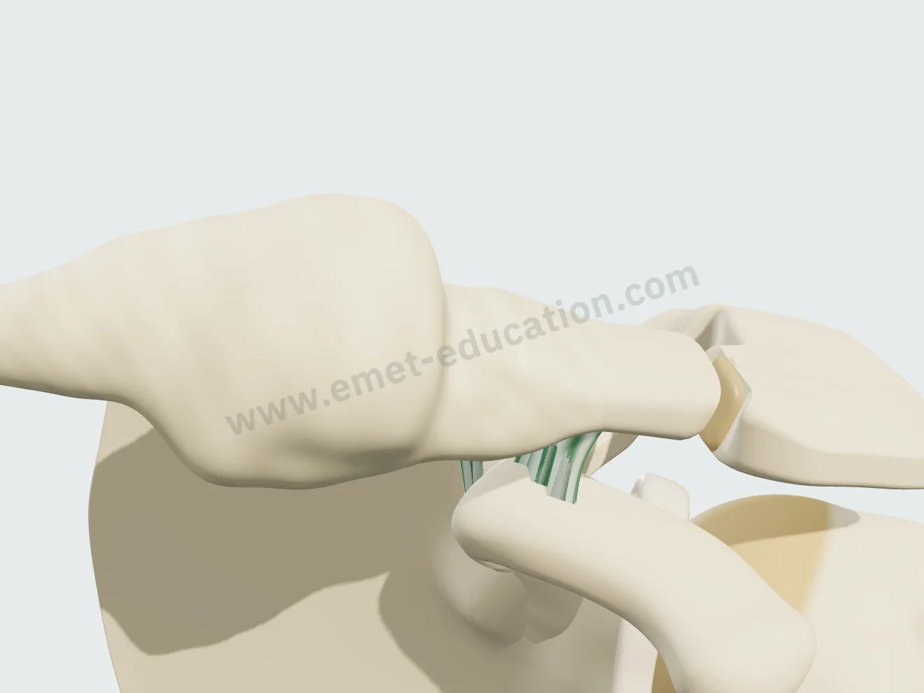 Nonoperative treatment, step 3: the hard callus, mineralized and bumpy.