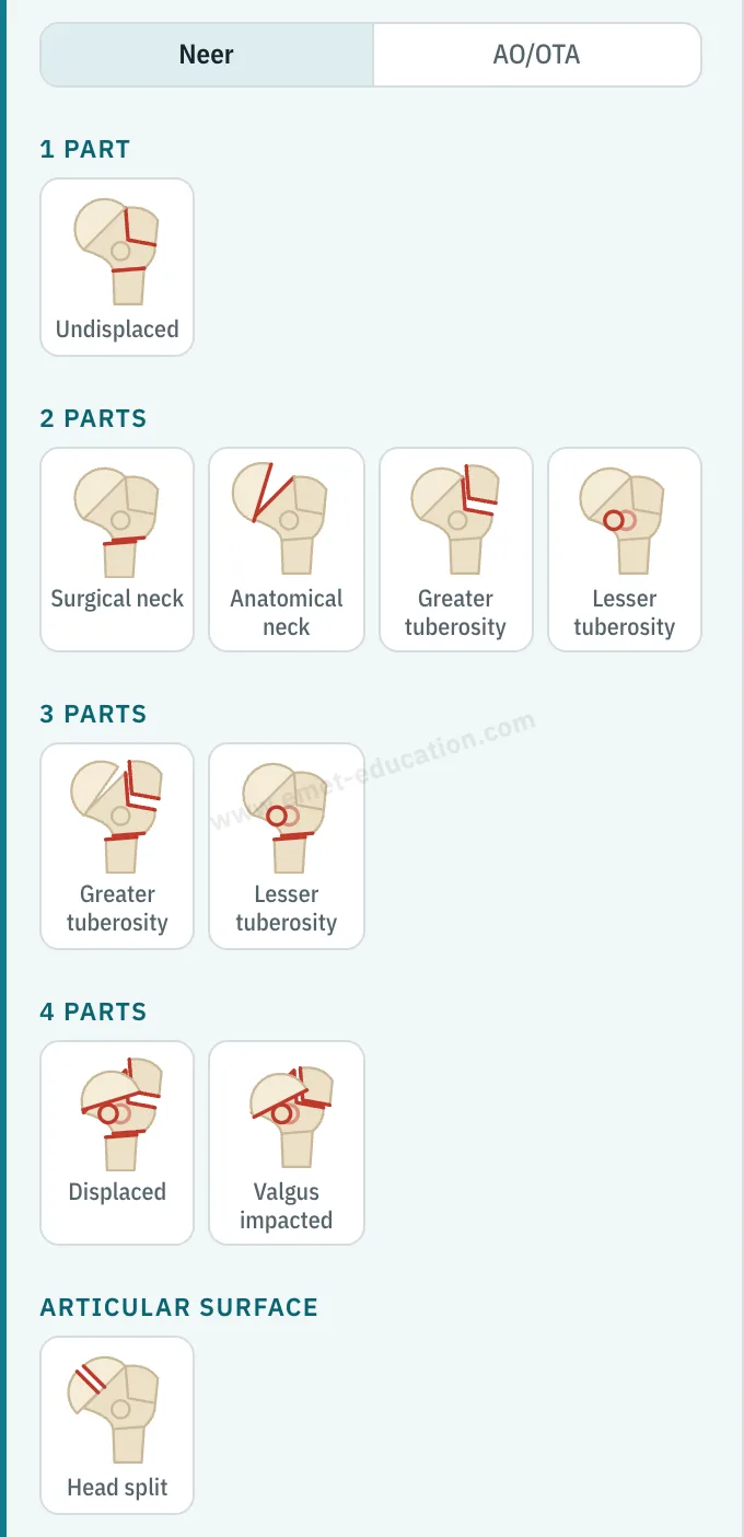 Model panel: Neer · AO/OTA switch, ten Neer pictograms grouped from 1 to 4 parts, and the articular surface.