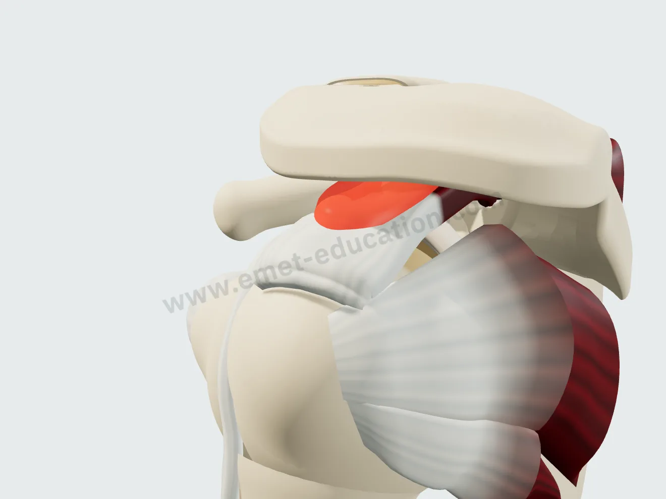 Subacromial bursitis: the bursa red and thickened under the acromion.