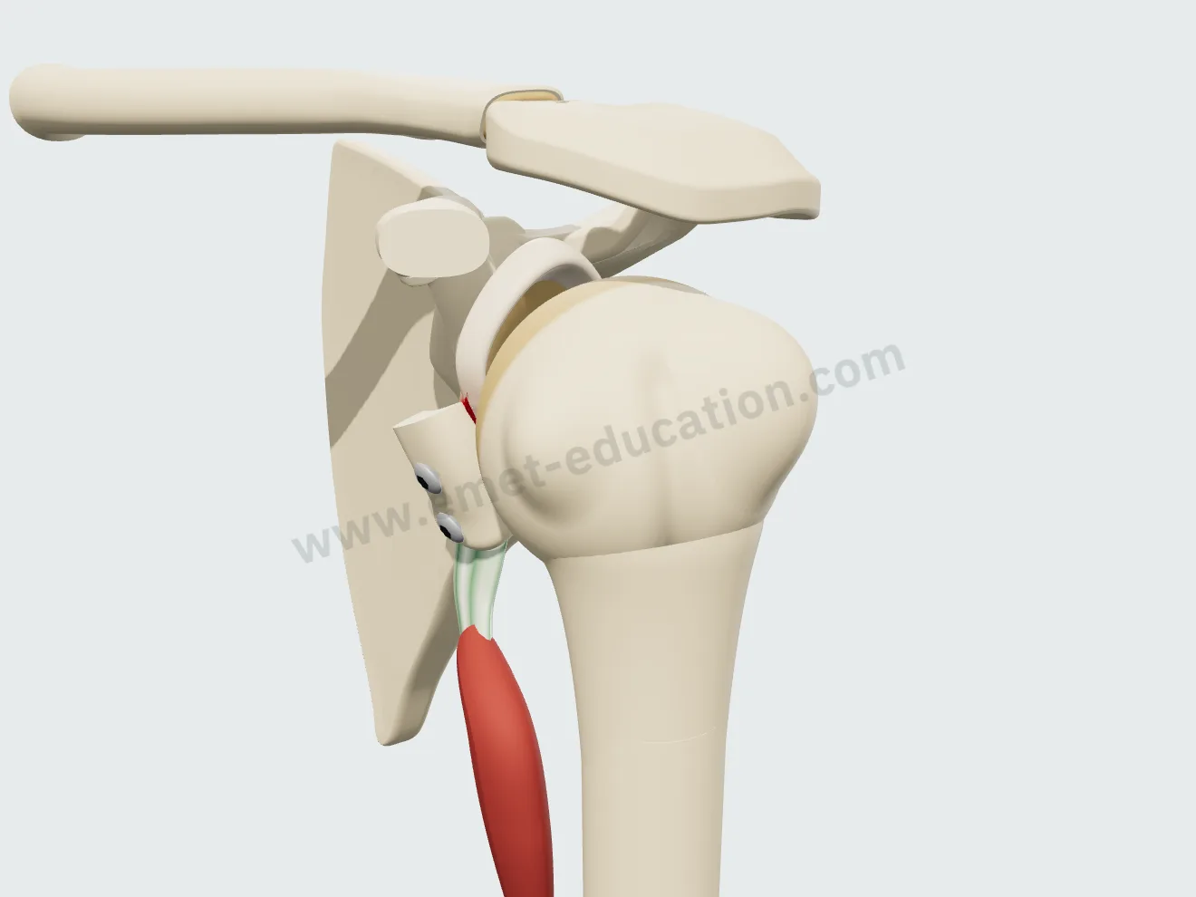 Latarjet procedure, step 6: humeral head in place, the conjoint tendon passing anteriorly and inferiorly forms a sling.