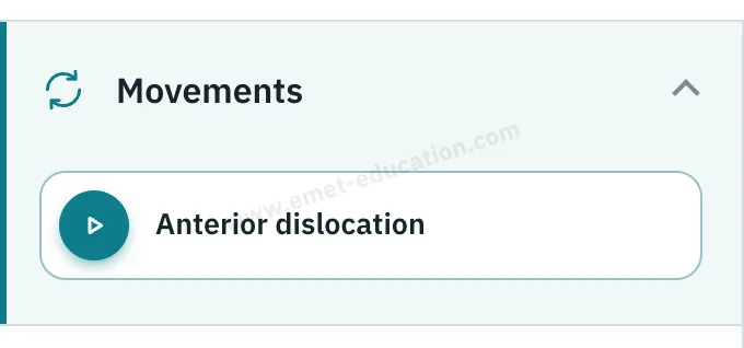 Model panel: “Movements” section, “Anterior dislocation” button.