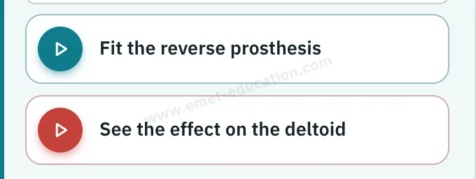 Model panel: reverse arthroplasty selected, “Fit the reverse prosthesis” and “See the effect on the deltoid” buttons.