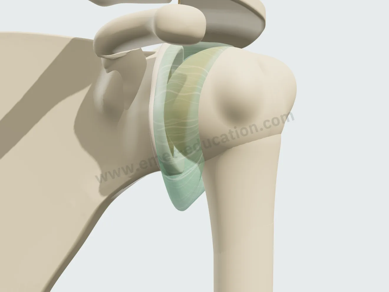 Distended capsule: deep axillary recess, redundant folds in front and behind.