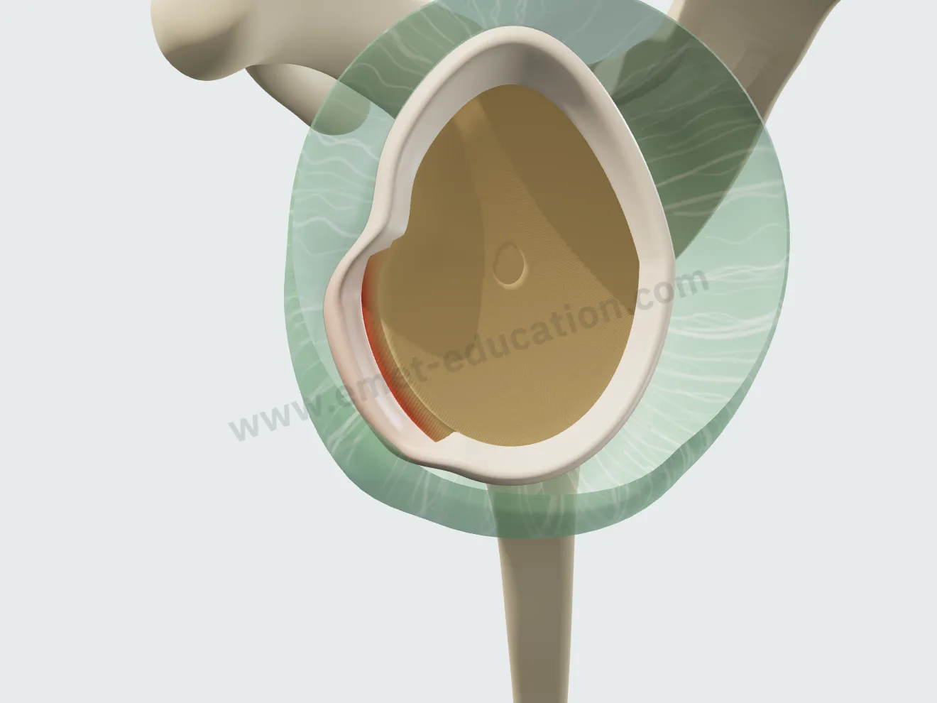 En face glenoid: the anteroinferior labrum detached, the bare rim shown in red.