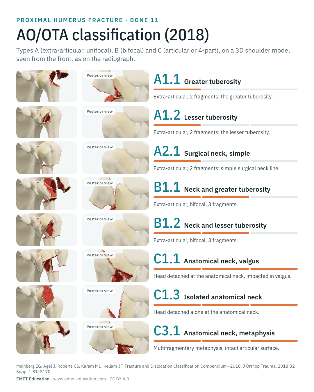 Portrait infographic of eight AO/OTA 2018 proximal humerus codes, one row per code.