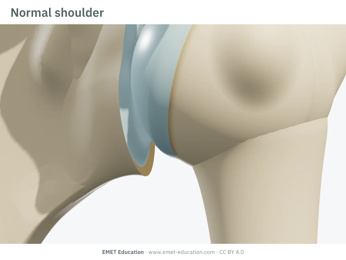 Shoulder in 3D, front view, normal: intact cartilage, inferior contours of the humeral head and glenoid without osteophyte.