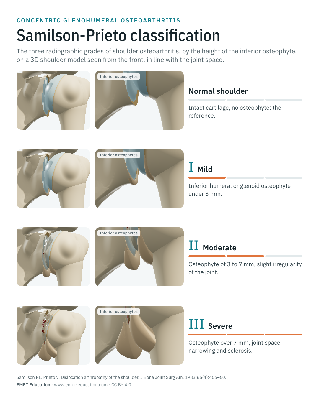 Portrait infographic of the Samilson-Prieto classification, one row per grade.