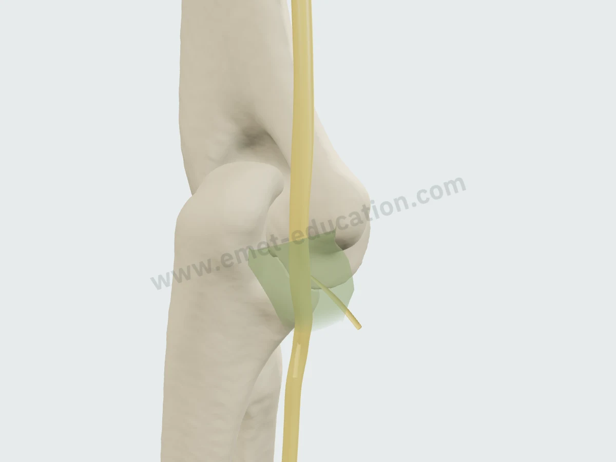 Épicondyle médial et olécrâne en 3D : le nerf ulnaire sous le toit translucide du tunnel cubital.