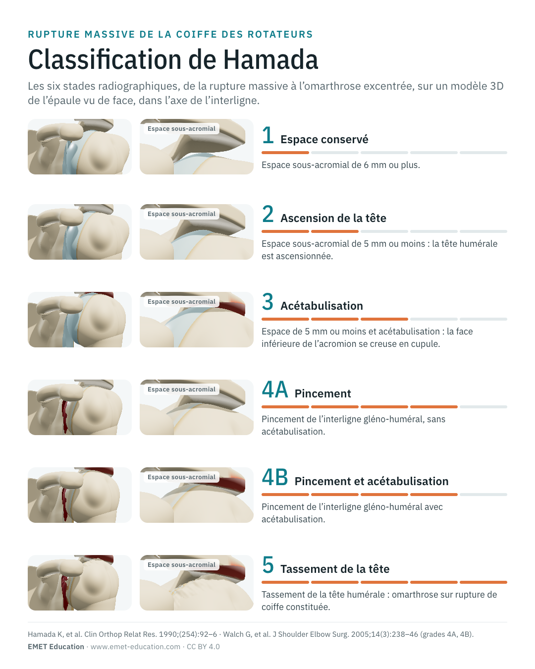Infographie en portrait des six grades de Hamada, une ligne par grade.