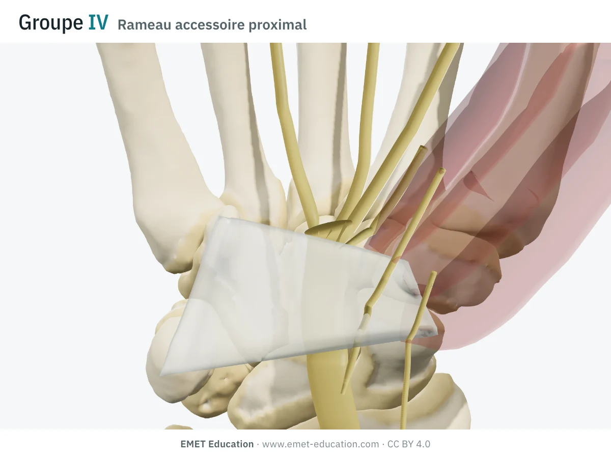 Poignet en 3D vu de face, Lanz IV : un rameau né avant le canal perce le ligament.