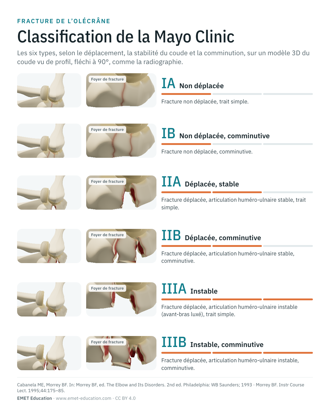 Infographie en portrait des six types de Mayo, une ligne par type.