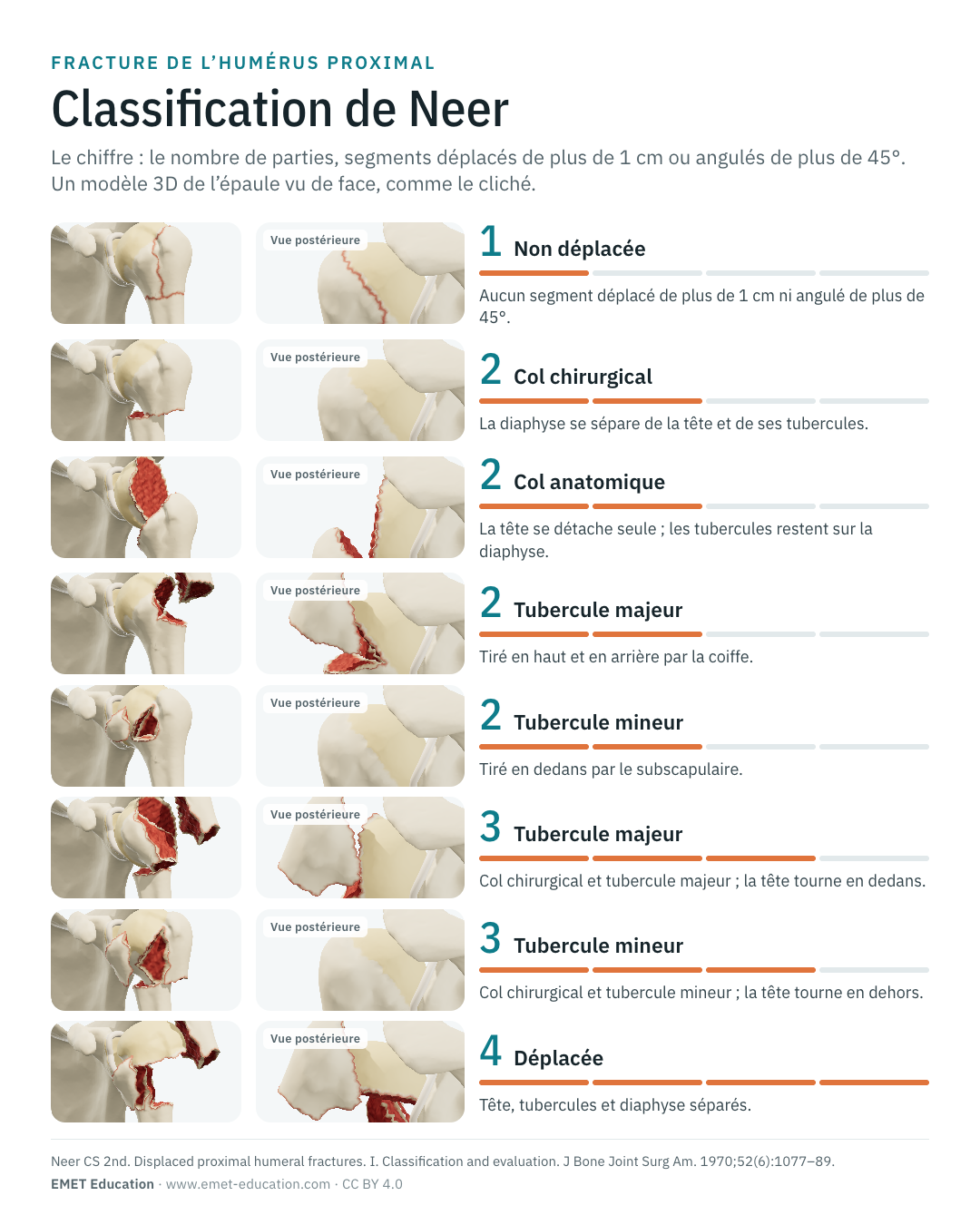 Infographie en portrait des catégories de Neer de 1 à 4 parties, une ligne par catégorie.