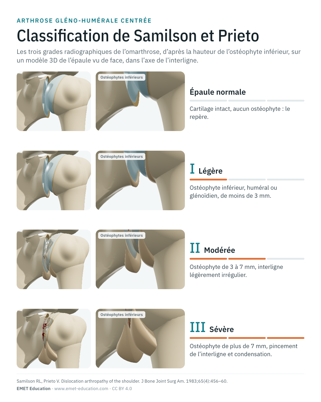 Infographie en portrait de la classification de Samilson et Prieto, une ligne par grade.