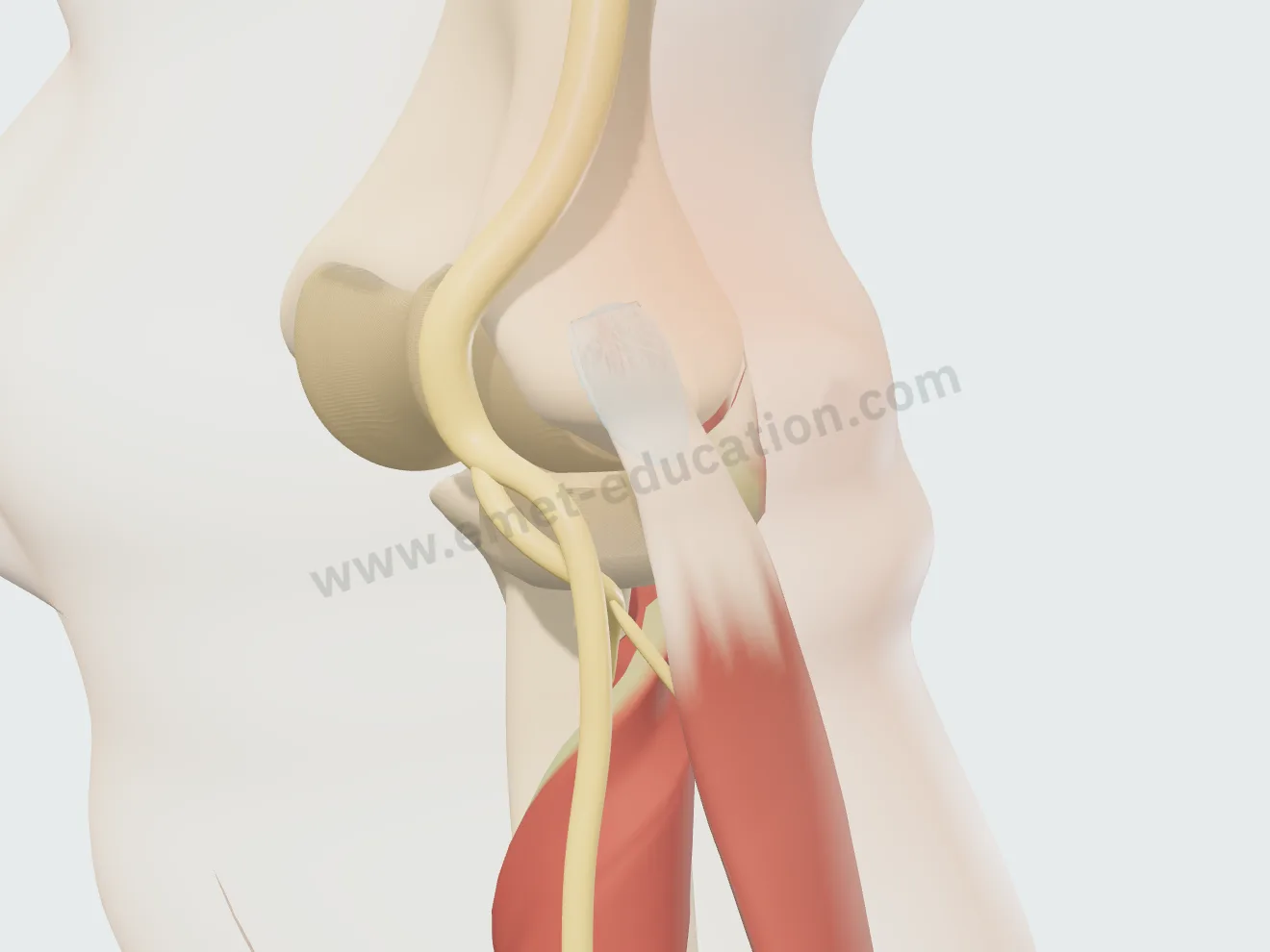 Après l'infiltration : la zone douloureuse a pâli sur la peau, mais le tendon reste abîmé.