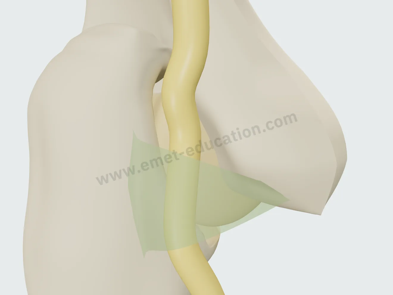 Tunnel cubital libre, coude tendu : le nerf ulnaire sous le ligament d'Osborne, sans lésion.