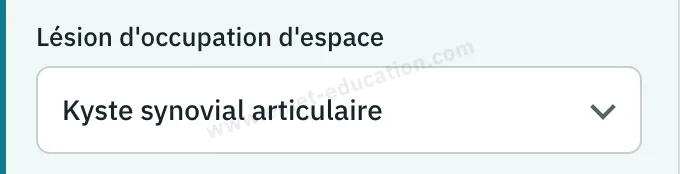 Panneau du modèle : lésion d'occupation d'espace, kyste synovial articulaire.