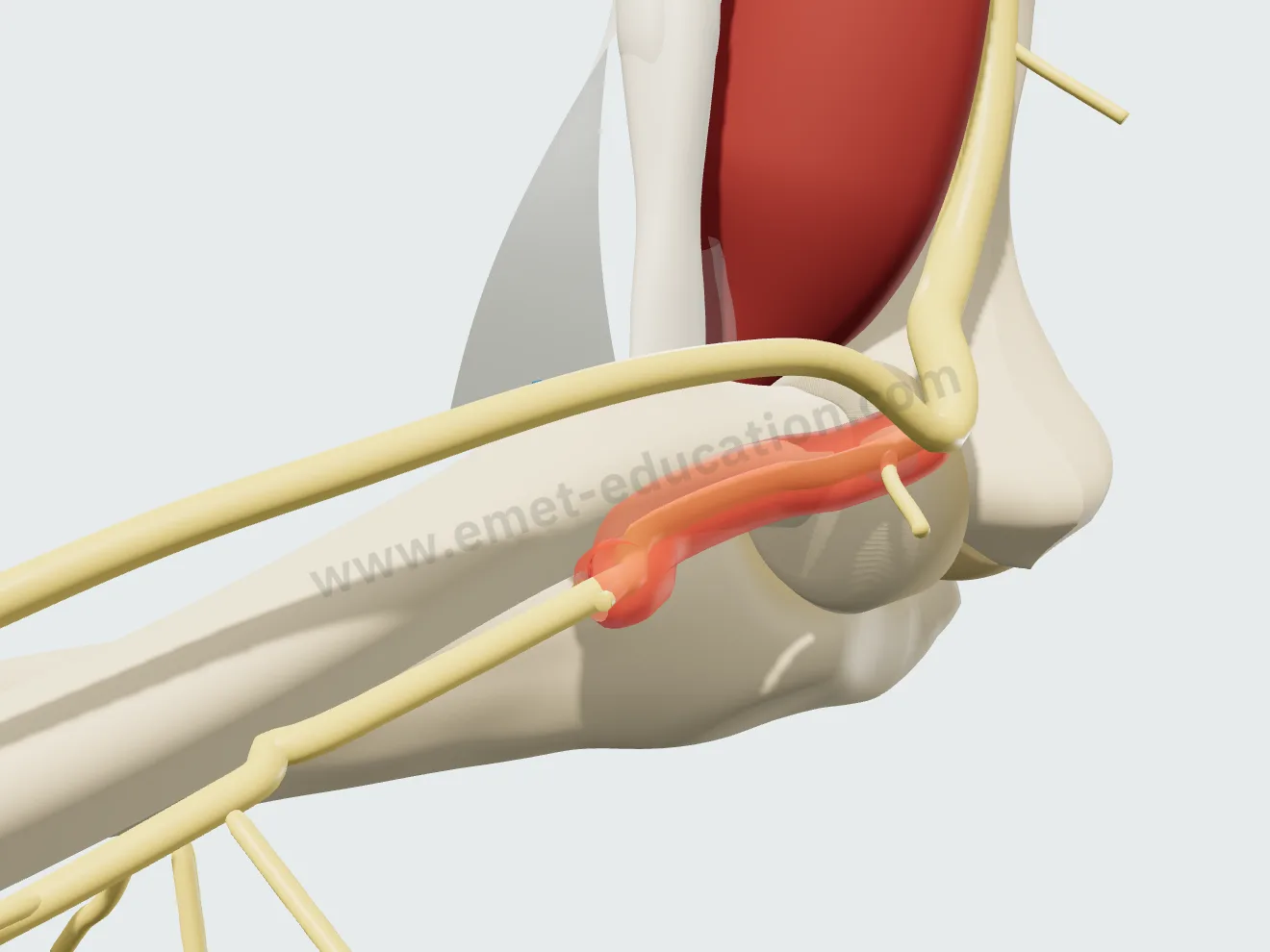 Le nerf radial et sa branche profonde, le nerf interosseux postérieur, qui passe contre le col du radius tout près de la zone de réinsertion.