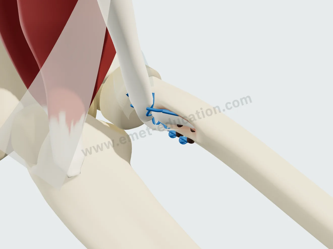 Sutures transosseuses : le tendon est enfoncé dans une cavité de la tubérosité, ses fils passés par trois trous et noués sur l'os.