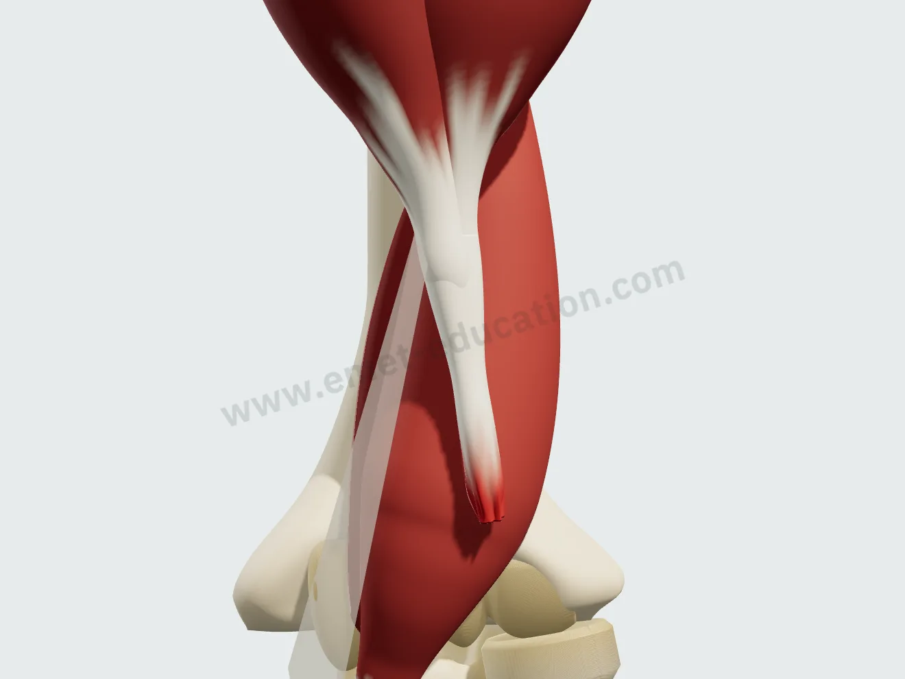 Le tendon rompu, retenu par le lacertus fibrosus resté intact et tendu vers l'intérieur de l'avant-bras.