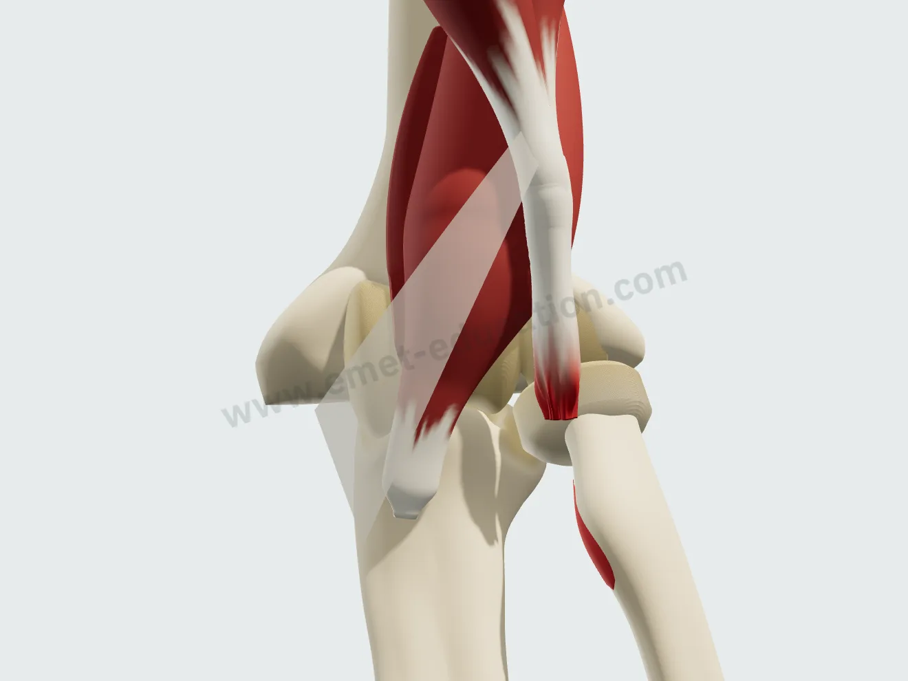 Le tendon arraché de la tubérosité du radius, son extrémité effilochée remontée d'un centimètre.