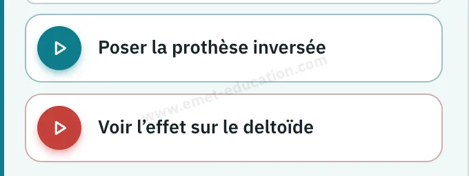 Panneau du modèle : prothèse inversée choisie, boutons « Poser la prothèse inversée » et « Voir l'effet sur le deltoïde ».