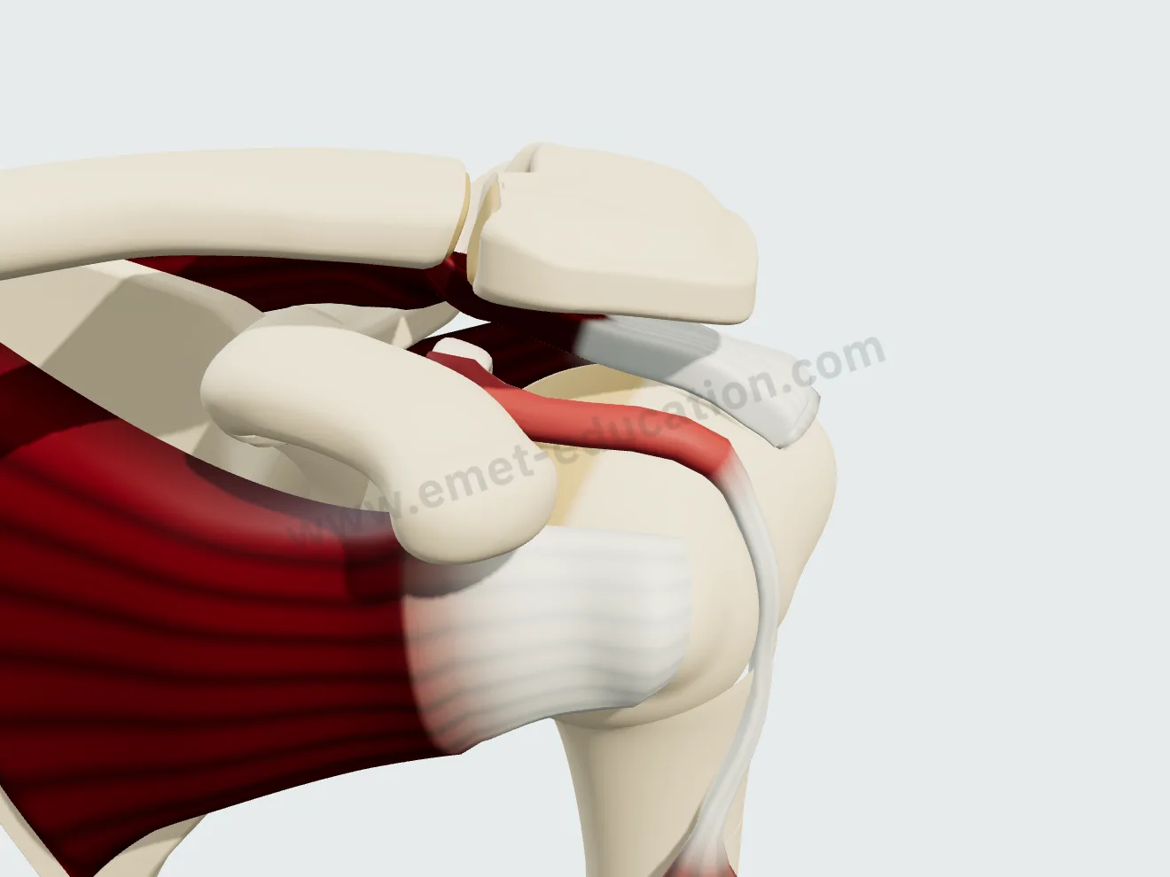 Ténosynovite du long biceps : la portion intra-articulaire du tendon épaissie et rouge.