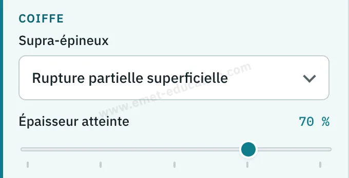 Panneau du modèle : supra-épineux, rupture partielle superficielle, épaisseur atteinte 70 %.
