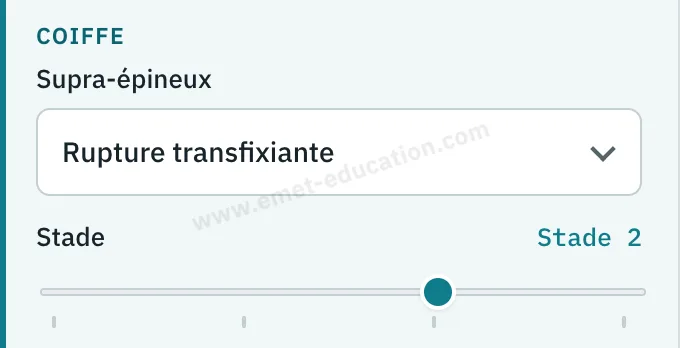 Panneau du modèle : supra-épineux, rupture transfixiante, stade 2.