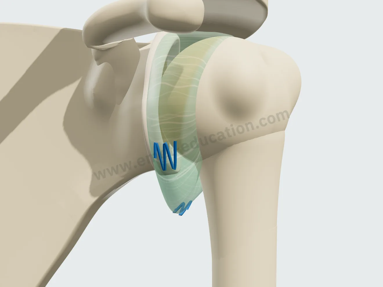 Retension capsulaire, étape 1 : trois points en paletot passés dans la moitié inférieure de la capsule distendue.
