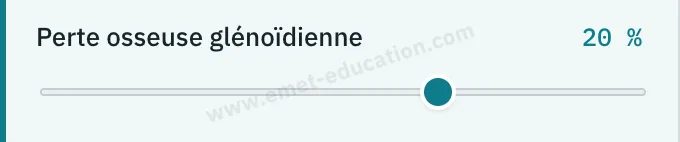 Panneau du modèle : perte osseuse glénoïdienne réglée à 20 %.