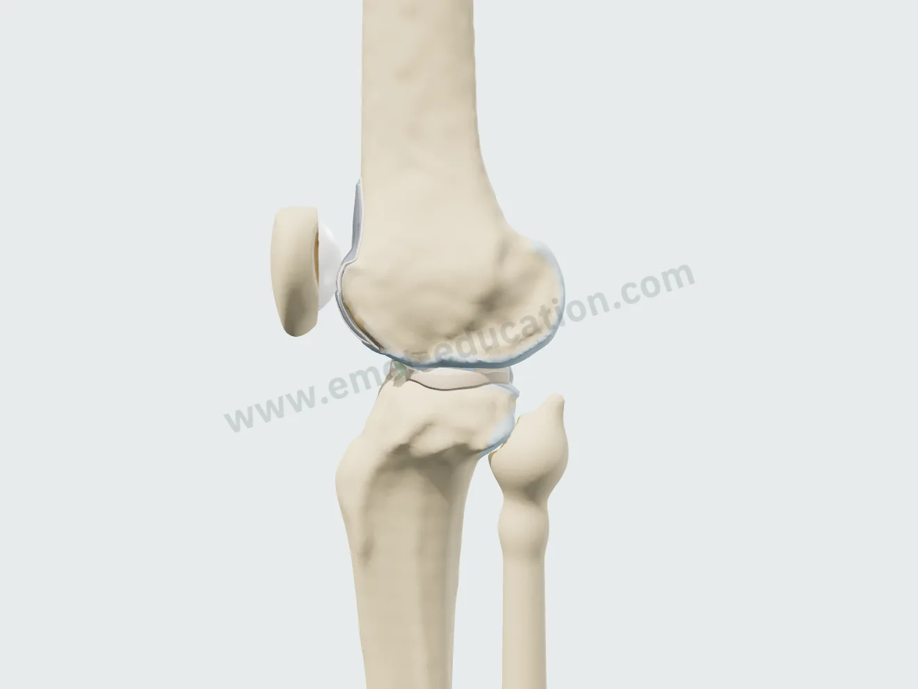 Prothèse fémoro-patellaire, étape 4 : flexion de profil, la rotule glisse dans la trochlée prothétique.