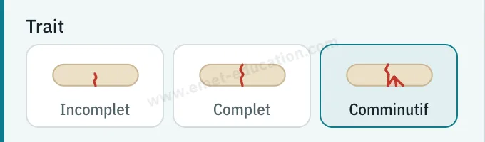 Panneau du modèle : trait incomplet, complet ou comminutif.