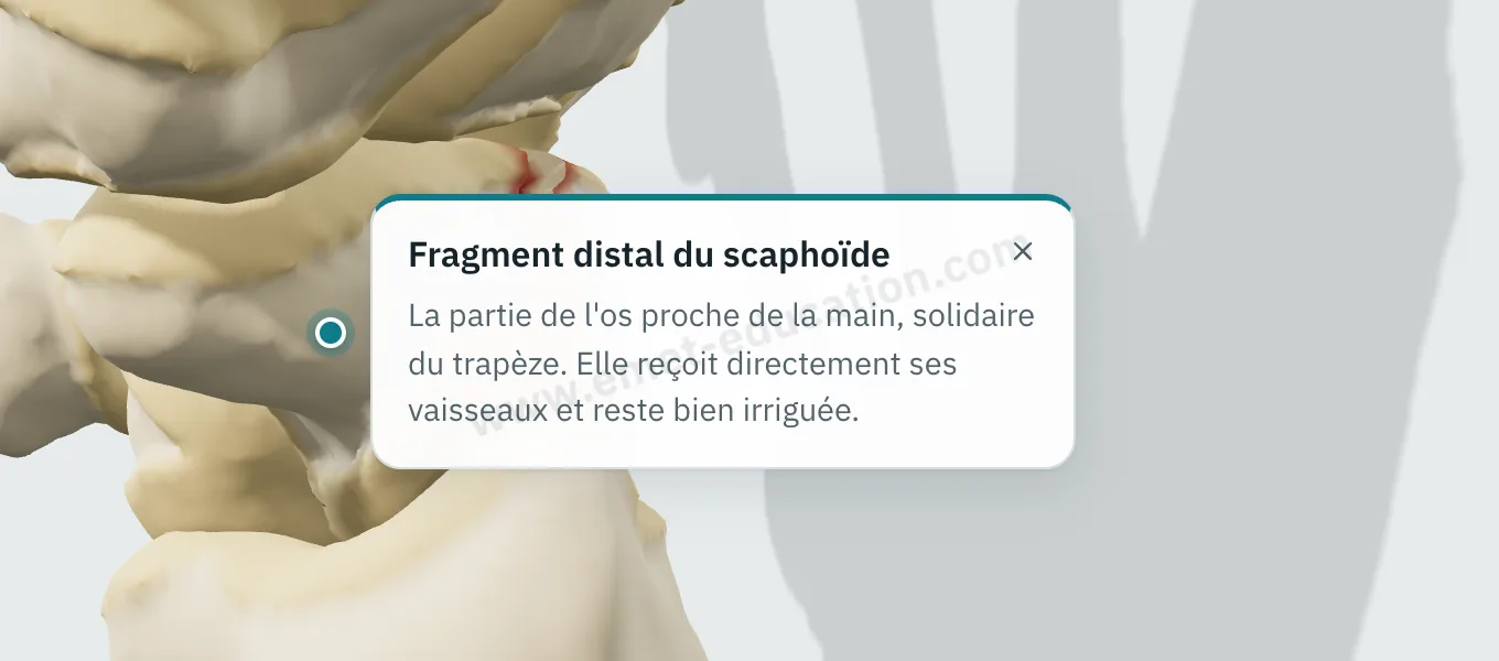 Bulle d'explication « Fragment distal du scaphoïde » affichée après un toucher sur le fragment.