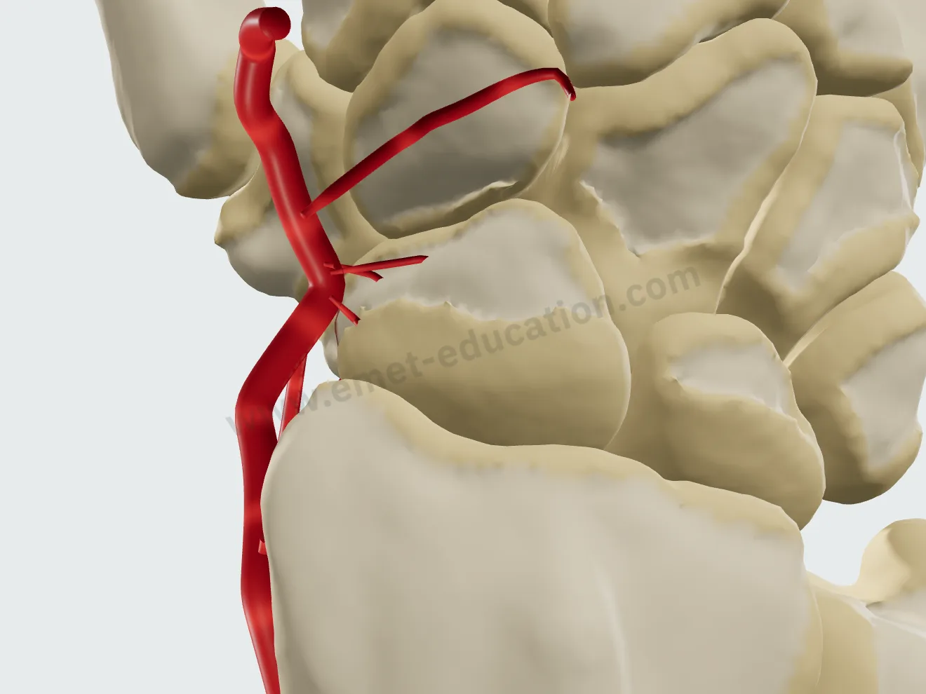 Fracture du tiers distal, vue dorsale : l'artère radiale et les vaisseaux du scaphoïde, tous perfusés.