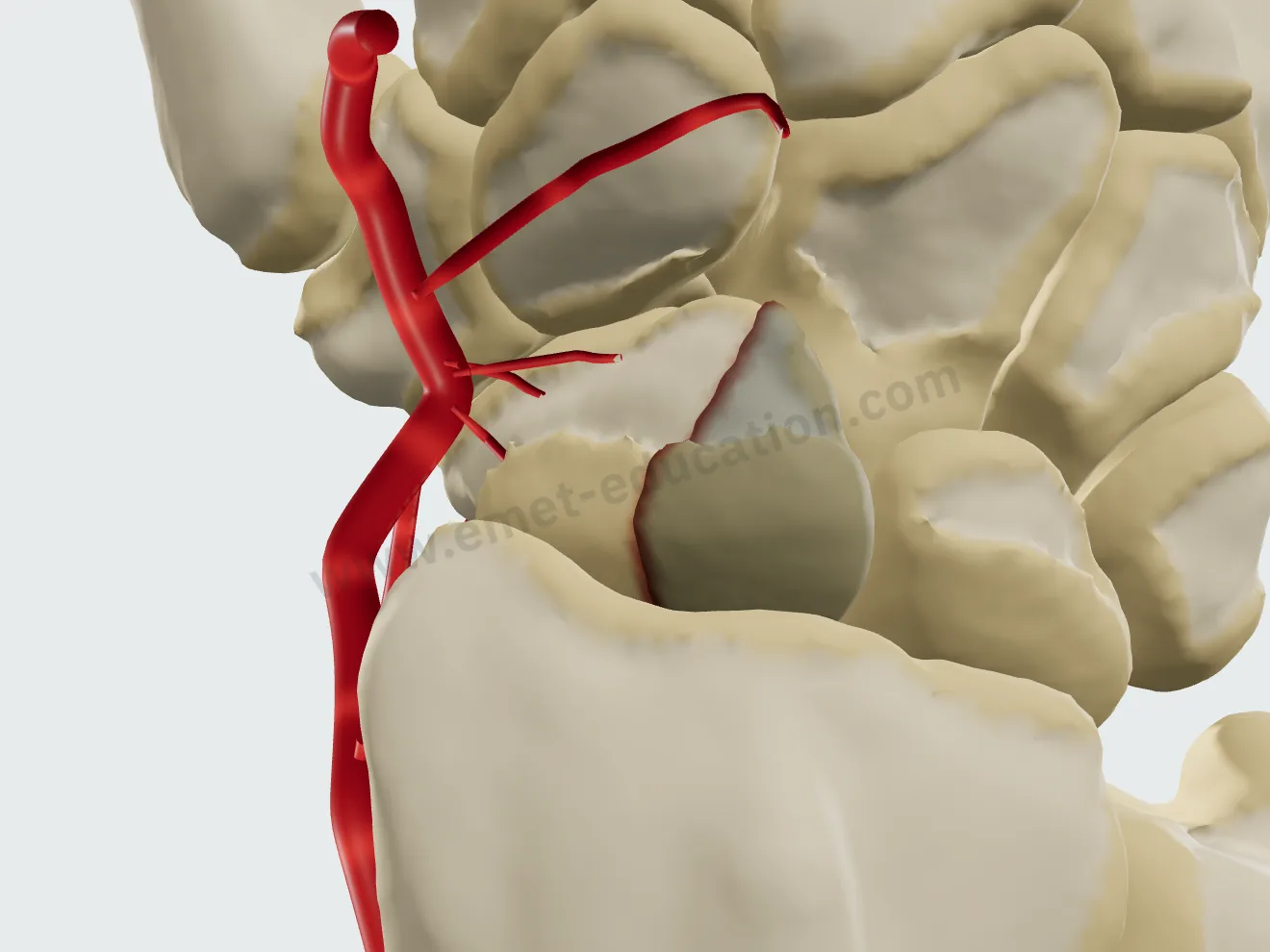 Fracture du pôle proximal, vue dorsale : le fragment proximal, privé de sang, a pâli.